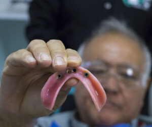 Placas Totales - ByC Clínica Dental